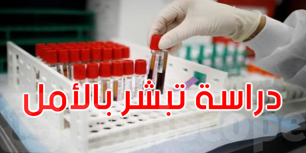 هل يمكن لفحص دم أن يكشف الزهايمر مبكرًا؟ دراسة تبشر بالأمل 