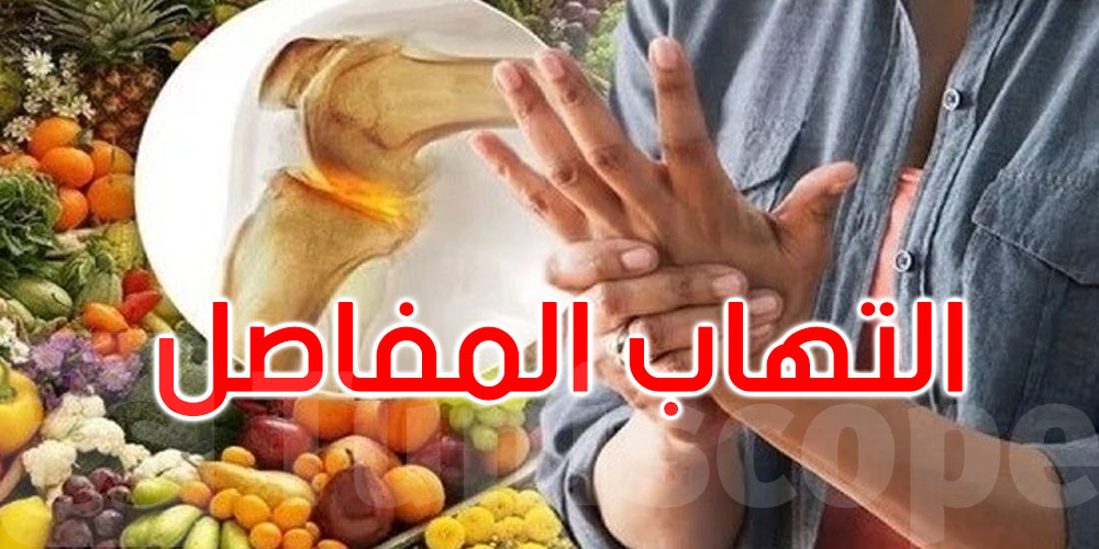   تعاني من التهاب المفاصل؟ هذه الأطعمة قد تغير حياتك