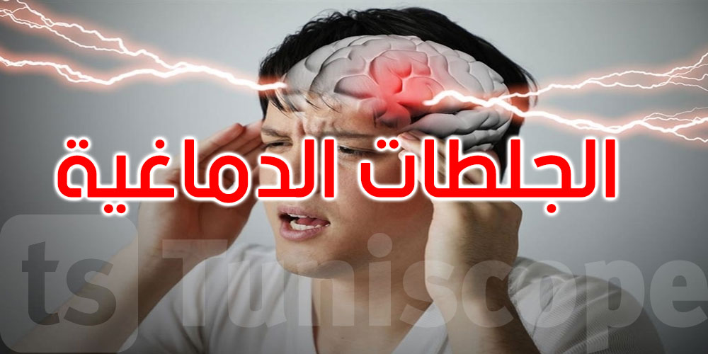 خطة وطنية لتحسين التكفل بالجلطات الدماغية والزهايمر: التفاصيل