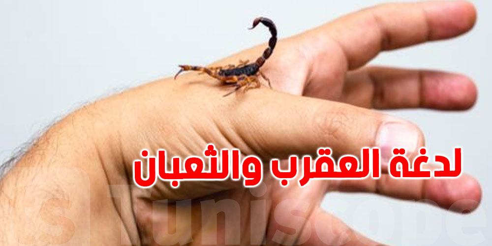 هام-وزارة الصحة تحذّر: العقارب والثعابين تهديد في الصيف
