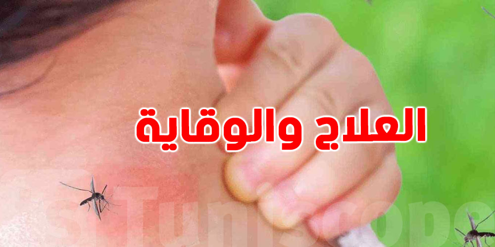 نصائح طبية للتعامل مع ''قرصة الناموس'' وطرق للوقاية منها