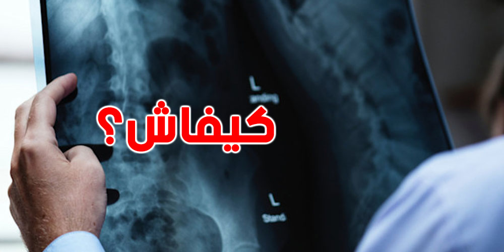 الخبراء يقولولكم على السرّ باش تحافظ على عظامك مع التقدم في السن