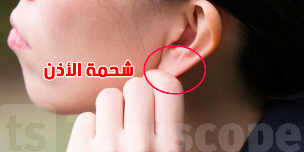 علامة بسيطة في الأذن قد تكشف خطر أمراض القلب