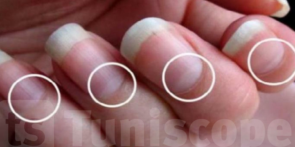 شنوّا يكشفوا أظافرك على صحتك...معلومات بش تصدمك ؟