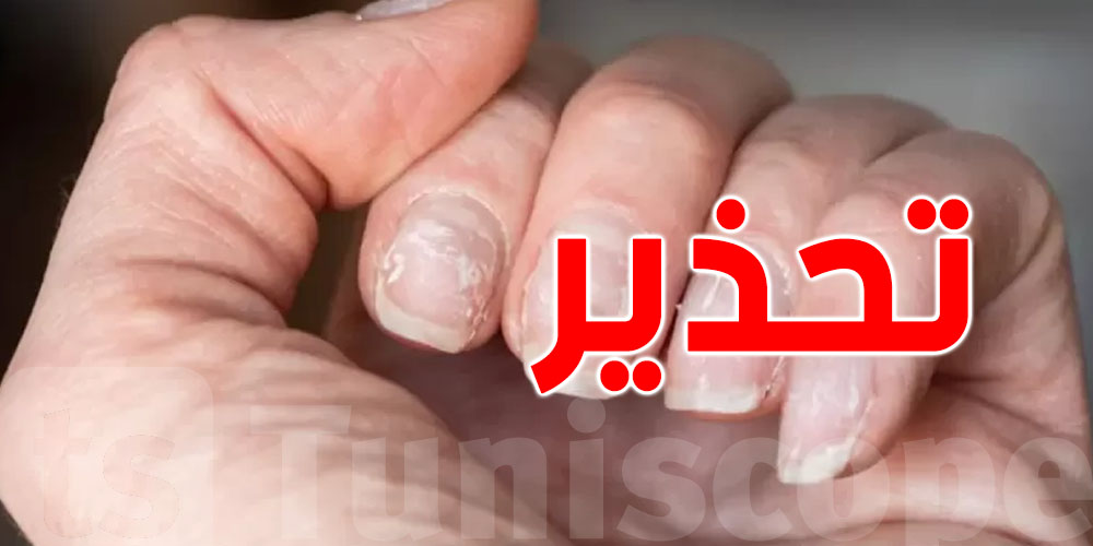 الدكتورة سارة حرباوي للتونسيين: فطريات الأظافر مرض صامت يهدّد الصحة