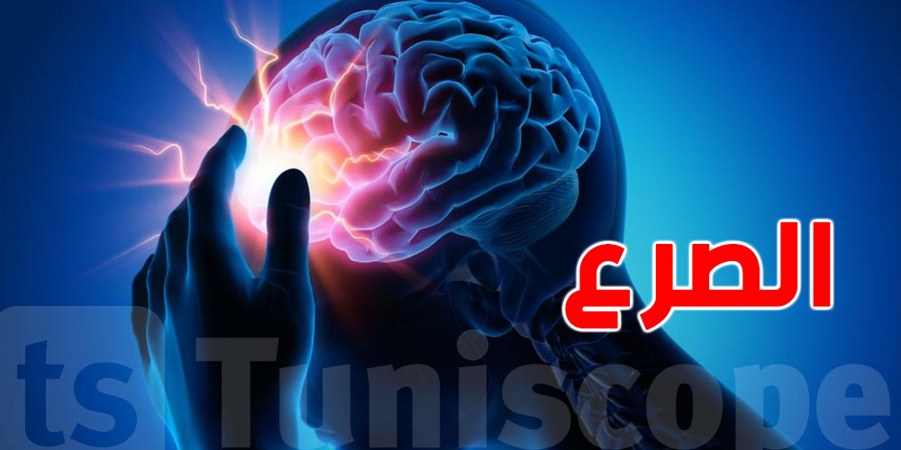 علاج جديد لمرض الصرع ...شنيا؟