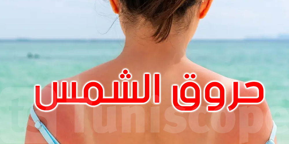 ‘تريند البرونزاج’ أو ‘حروق الشمس’.. على ‘تيك توك’ يغضب فرنسا