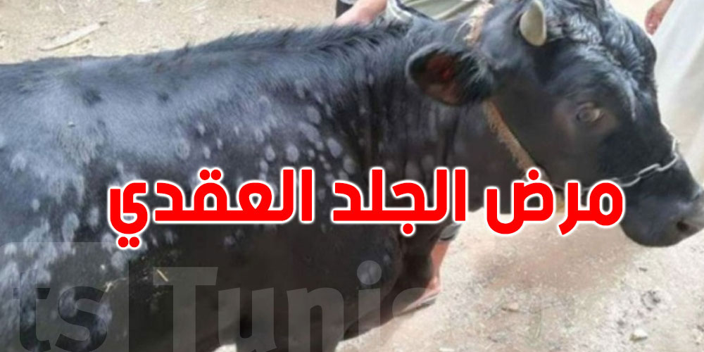  بعد حملة تلقيح واسعة: خطر الجلد العقدي يتراجع في الكاف