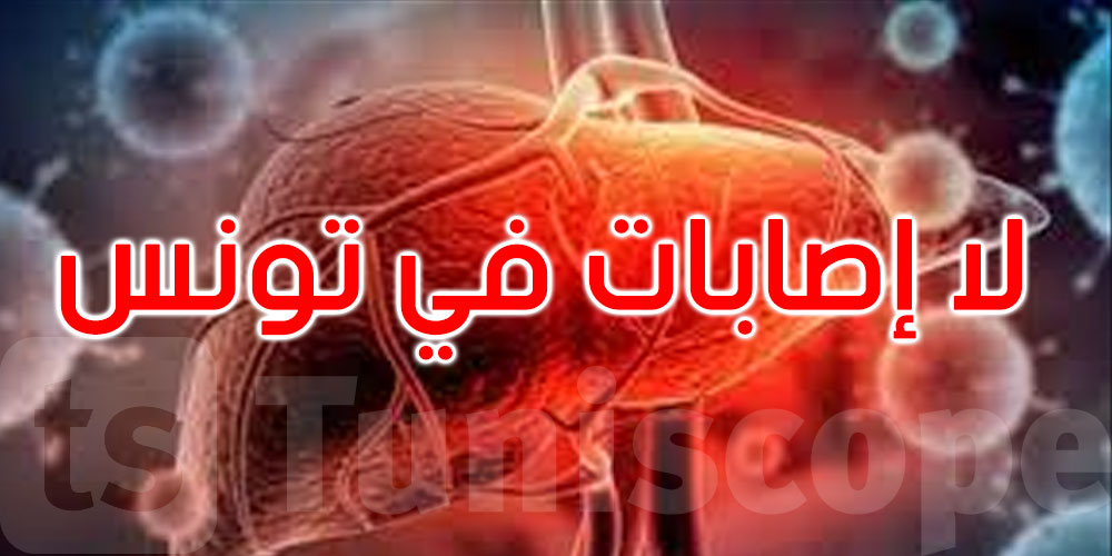 الالتهاب الكبدي الحاد غير معروف المنشإ لدى الأطفال: تونس لم تسجل أي إصابة