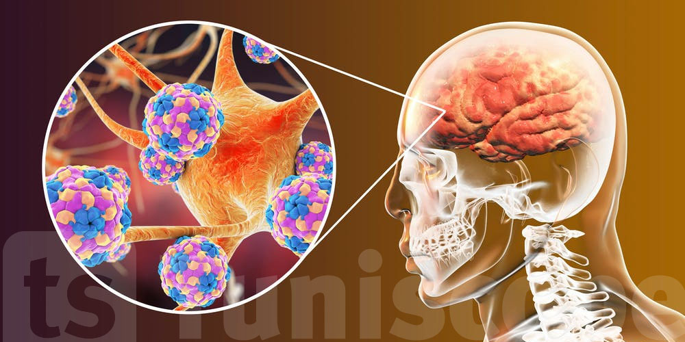 أثار القلق في القيروان :  نصائح طبية مهمة للوقاية من الـ Méningite