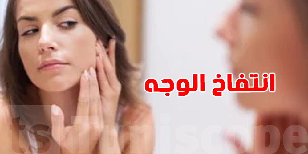 انتفاخ الوجه صباحًا: علامات بسيطة تنجم تكون وراها مشاكل صحية خطيرة