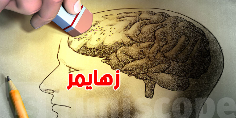 تونس ممكن على موعد مع 45 ألف حالة زهايمر قبل 2030!