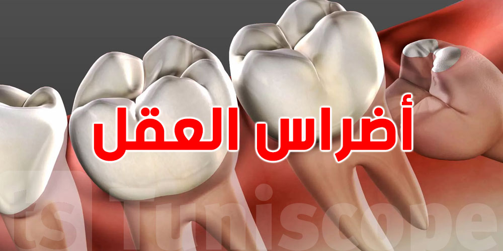 هام: أضراس العقل تخبّئ مفاجأة طبية مذهلة...سرّ الشفاء من أمراض خطيرة!